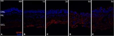 Programmed Cell Death and Autophagy in an in vitro Model of Spontaneous Neuroretinal Degeneration